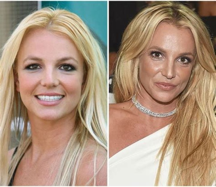 Britney Spears Plastic Surgery Before and After