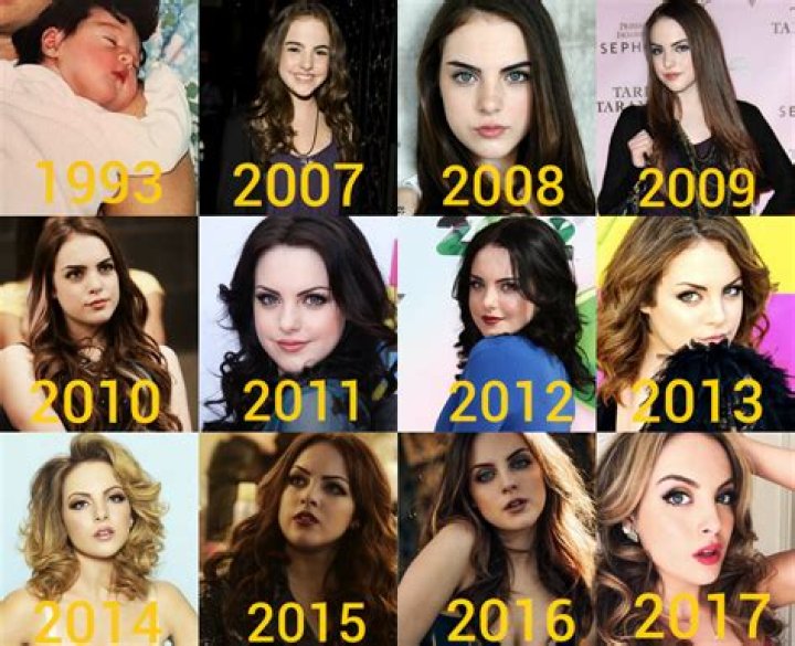 Elizabeth Gillies Plastic Surgery Before and After