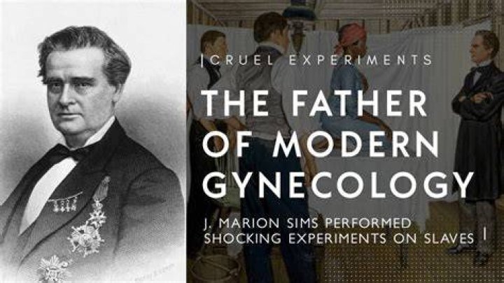 J. Marion Sims J. Marion Sims