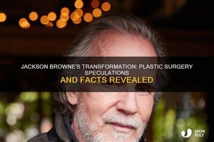 Jackson Browne plastic surgery
