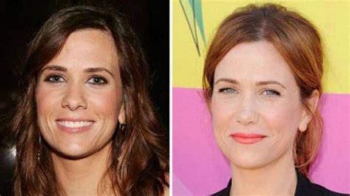 Kristen Wiig Plastic Surgery Before and After