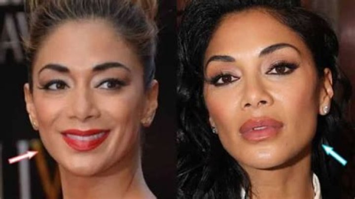 Nicole Scherzinger Plastic Surgery Before and After