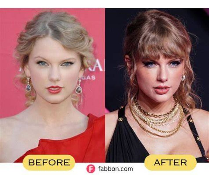 Taylor Swift Plastic Surgery Before and After